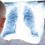 Radiography