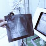A cutting-edge x-ray machine in a hospital room that incorporates the history of digital radiography.