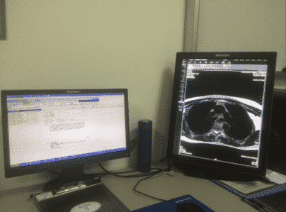 X 線画像を表示する医療用コンピューターの画面。