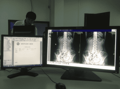コンピュータ画面に X 線画像を表示する医療用モニター。