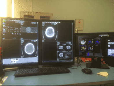 コンピュータ画面に X 線画像を表示する医療用モニター。