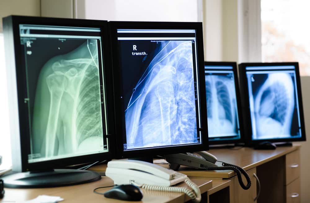 X-ray monitors displaying digital radiography and computed radiography images.