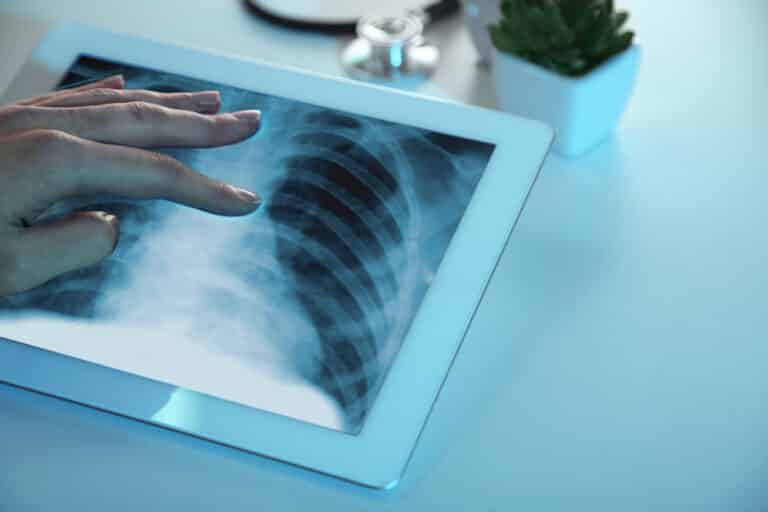 Doktor tangan menyentuh tablet digital moden dan melihat gambaran radiograf
