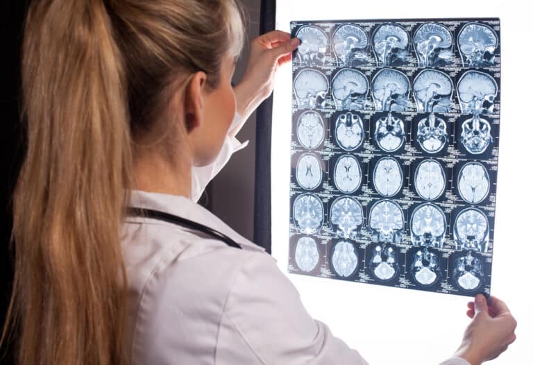 Doctor woman holding xray film