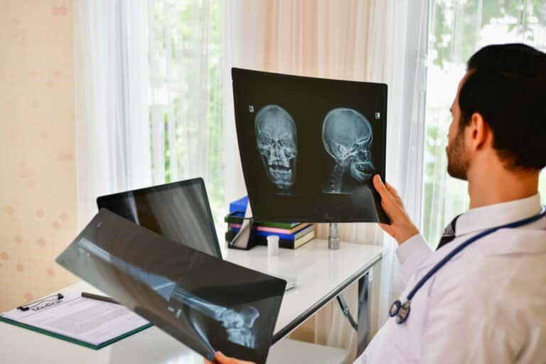 doktor memegang filem radiografi digital