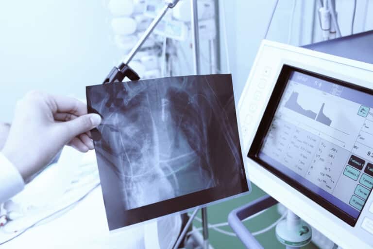 History Of Digital Radiography And Xray Nano Medic Care