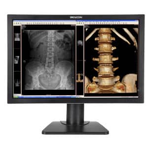 A medical monitor displaying x-ray images.