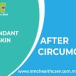 Redundant Foreskin After Circumcision