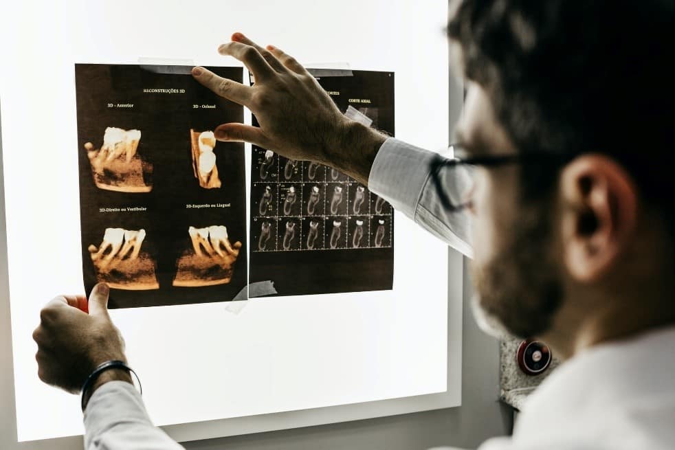 gambar doktor sedang melihat gambar radiografi