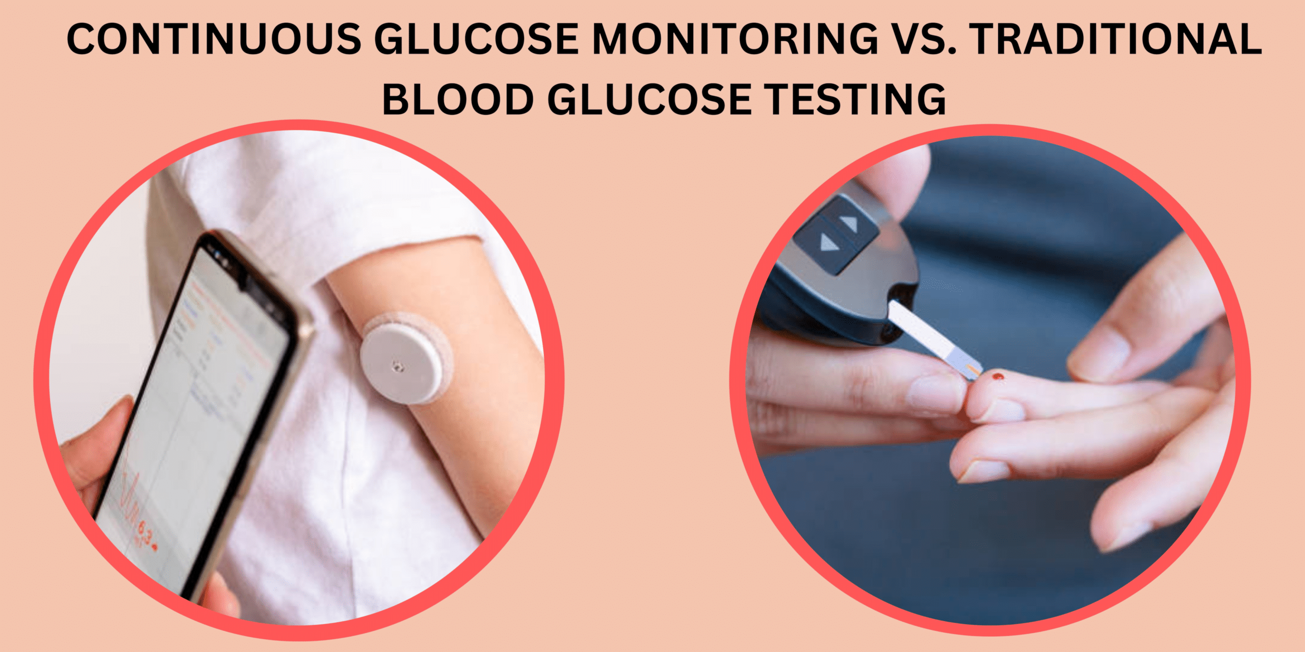 一篇关于连续血糖监测 Vs 的文章的图像。 传统血糖测试